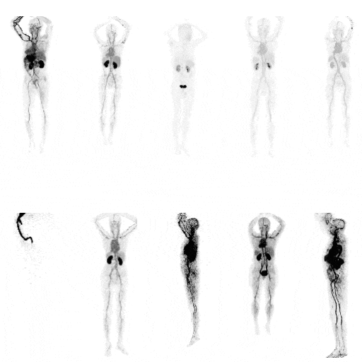 Total-body PET scanner concept.